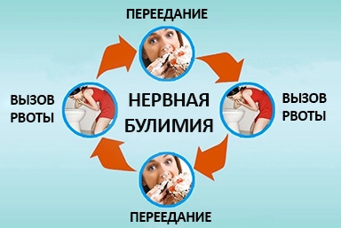 Лечение булимии в Невинномысске